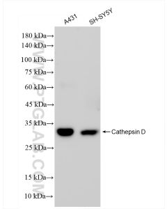 Cathepsin D Recombinant monoclonal antibody Proteintech  83743-2-RR