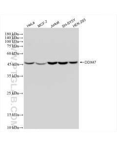 DDX47 Recombinant monoclonal antibody Proteintech  83287-3-RR
