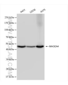 MAGEA4 Recombinant monoclonal antibody Proteintech  84248-4-RR