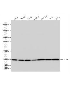 G-CSF Recombinant monoclonal antibody Proteintech  86376-1-RR