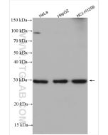 SLC25A1 Polyclonal antibody proteintech 15235-1-AP