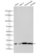 RAB10 Polyclonal antibody proteintech 11808-1-AP