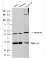 Cathepsin K Polyclonal antibody proteintech 11239-1-AP