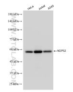 NDP52 Polyclonal antibody proteintech 12229-1-AP