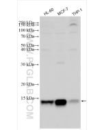 S100A9 Polyclonal antibody proteintech 26992-1-AP