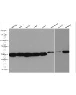 ERGIC-53 Polyclonal antibody proteintech 13364-1-AP