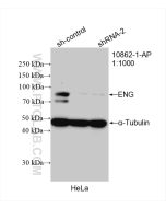 Endoglin/CD105 Polyclonal antibody proteintech 10862-1-AP
