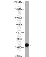 GNMT Polyclonal antibody proteintech 18790-1-AP