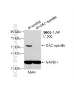 GAC-specific Polyclonal antibody proteintech 19958-1-AP