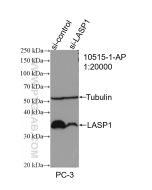LASP1 Polyclonal antibody proteintech 10515-1-AP