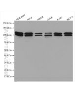 BRD3 Polyclonal antibody proteintech 11859-1-AP