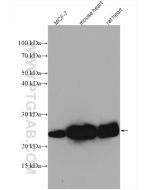 UQCRFS1 Polyclonal antibody proteintech 18443-1-AP
