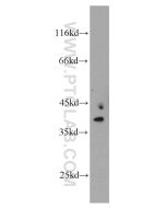MRPS22 Polyclonal antibody proteintech 10984-1-AP