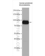 CD36 Polyclonal antibody proteintech 18836-1-AP