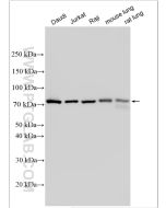 GCLC Polyclonal antibody proteintech 12601-1-AP