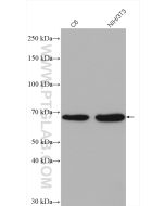 PAK1 Polyclonal antibody proteintech 21401-1-AP