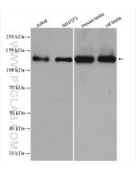 DNMT3A Polyclonal antibody proteintech 20954-1-AP
