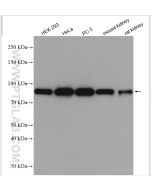 DDX1 Polyclonal antibody proteintech 11357-1-AP