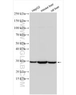 SDHB Polyclonal antibody proteintech 10620-1-AP
