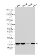 IL-18 Polyclonal antibody proteintech 10663-1-AP