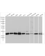 GSTP1 Polyclonal antibody proteintech 15902-1-AP