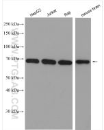 Lamin B2 Polyclonal antibody proteintech 10895-1-AP