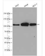 RB1 Polyclonal antibody proteintech 10048-2-Ig