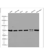 COX2/ Cyclooxygenase 2/ PTGS2 Polyclonal antibody proteintech 12375-1-AP