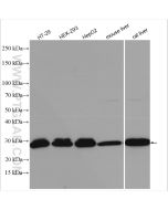 SIRT3 Polyclonal antibody proteintech 10099-1-AP