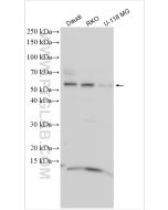 KBTBD8 Polyclonal antibody proteintech 31970-1-AP