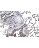 Uteroglobin/CC10 Polyclonal antibody proteintech 10490-1-AP