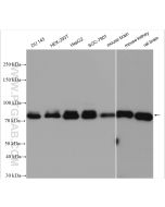 FOXO1 Polyclonal antibody proteintech 18592-1-AP