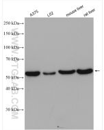 ERp57/ERp60 Polyclonal antibody proteintech 15967-1-AP
