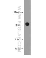 SESN1 Polyclonal antibody proteintech 21668-1-AP