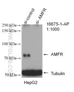 AMFR/GP78 Polyclonal antibody proteintech 16675-1-AP