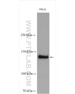 NBR1 Polyclonal antibody proteintech 16004-1-AP