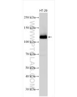 EPHB4 Polyclonal antibody proteintech 20883-1-AP