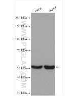 CYP51A1 Polyclonal antibody proteintech 13431-1-AP
