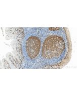 Ki-67 Polyclonal antibody proteintech 27309-1-AP