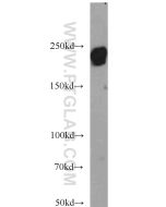 Laminin beta 1 Polyclonal antibody proteintech 23498-1-AP