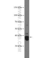SOX2 Polyclonal antibody proteintech 11064-1-AP
