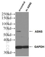 ASNS Polyclonal antibody proteintech 14681-1-AP
