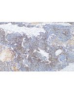 Chromogranin A Polyclonal antibody proteintech 23342-1-AP