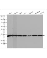 HPRT Polyclonal antibody proteintech 15059-1-AP