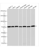 GRP78/BIP Polyclonal antibody proteintech 11587-1-AP