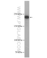 REST Polyclonal antibody proteintech 22242-1-AP