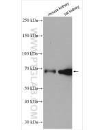 TORC2 Polyclonal antibody proteintech 12497-1-AP
