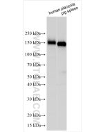 CD163 Polyclonal antibody proteintech 16646-1-AP