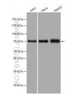 MAVS; VISA Polyclonal antibody proteintech 14341-1-AP