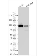 STAT5A/B Polyclonal antibody proteintech 13179-1-AP